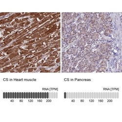 CS Citrate Synthase Antibody, Novus Biologicals:Antibodies:Primary Antibodies